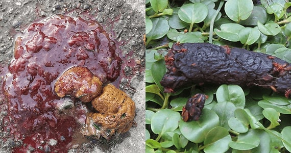 Photograph blood in poo and black poo,