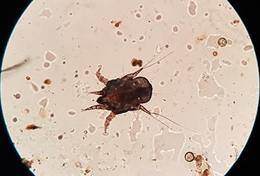 Photo of an ear mite under microscope