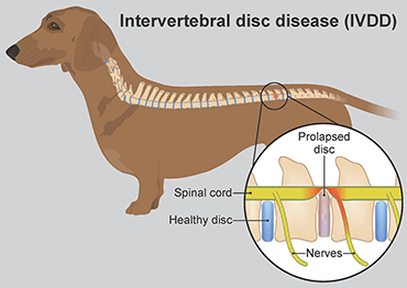 Illustration of IVDD on a Dacshund