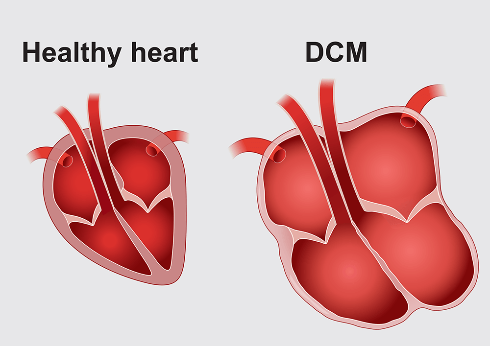 can dilated cardiomyopathy be cured in dogs