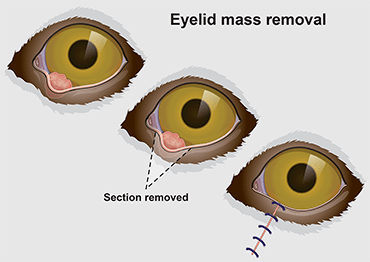 An illustration explaining how eye masses are removed
