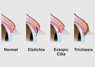 Illustration of eyelash problems in dogs