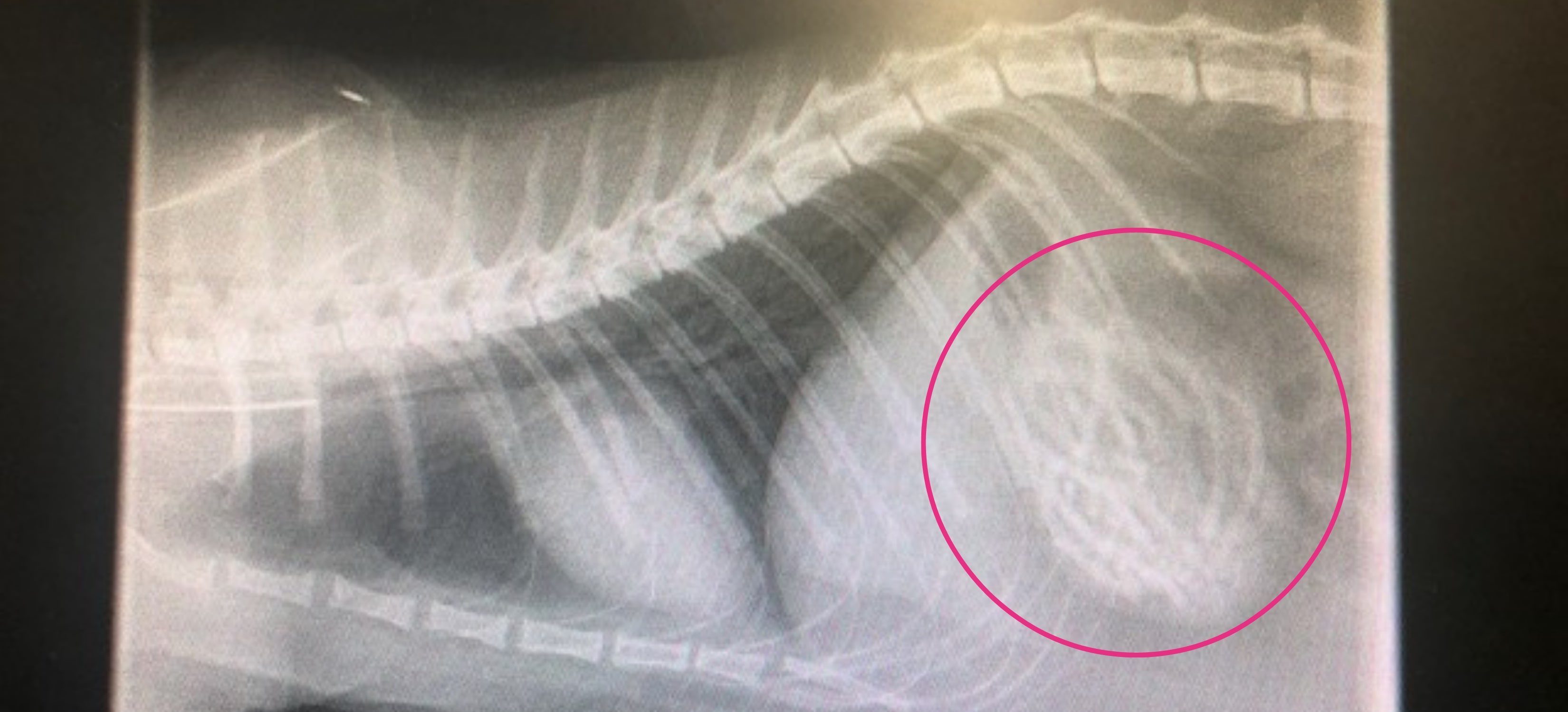 Xray showing the bundle of hairbands in Irwin's guts