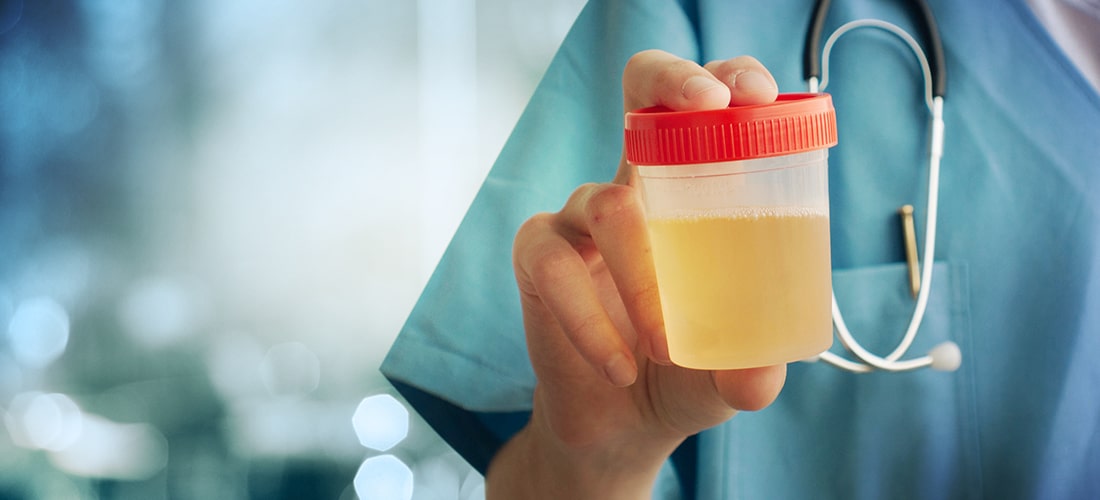 An image of a vet holding a container of urine