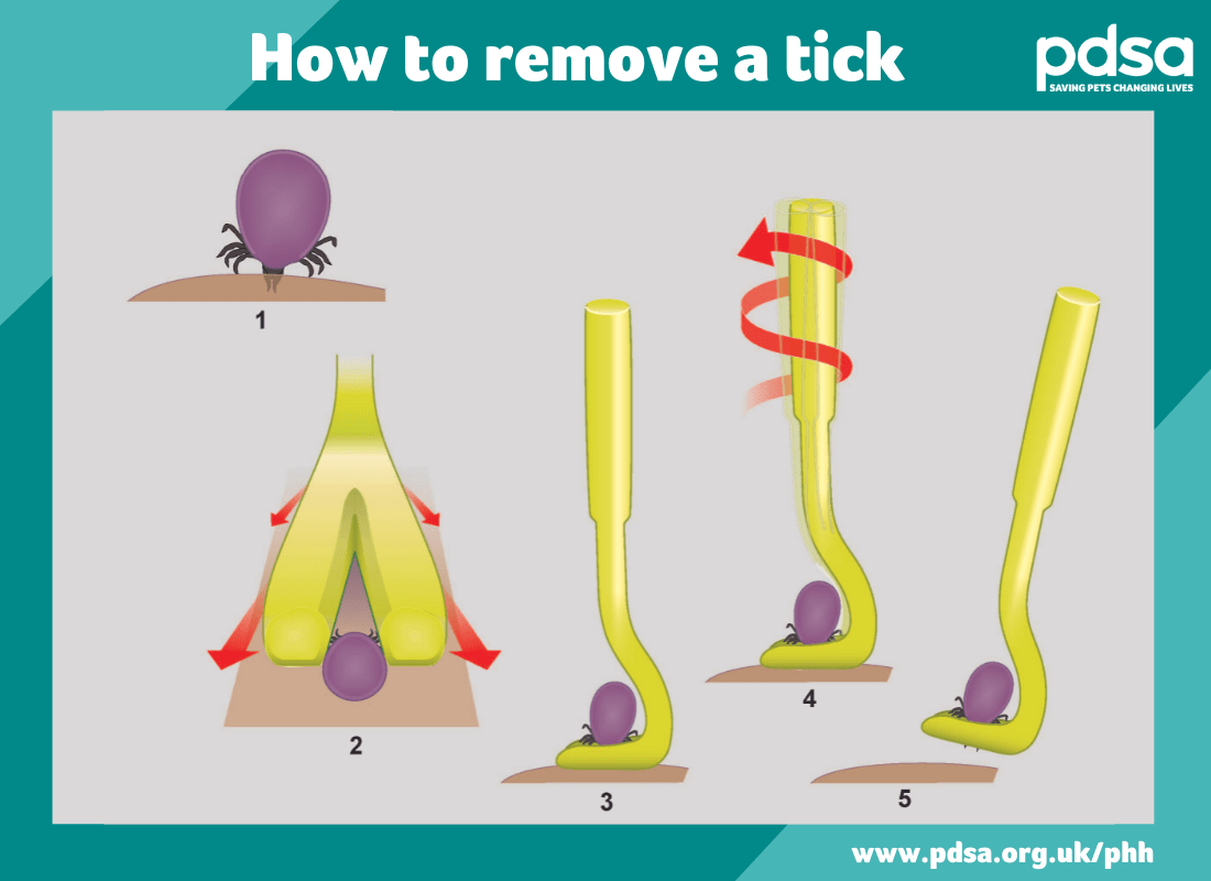 An illustration showing how to remove a tick