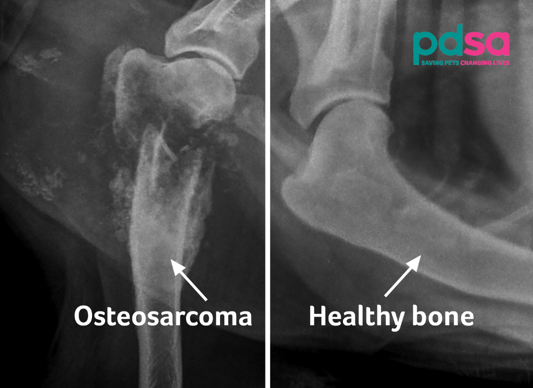 Xrays showing healthy bone vs osteosarcoma