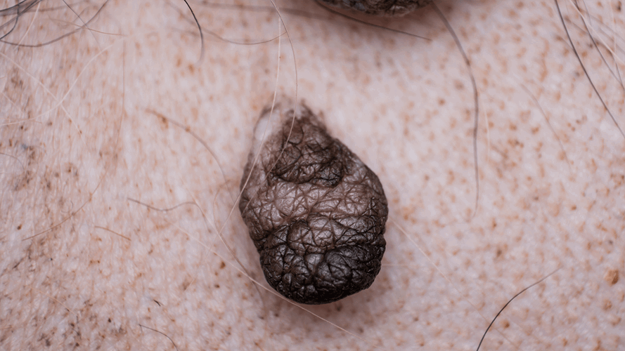 Black ball on dog outlet