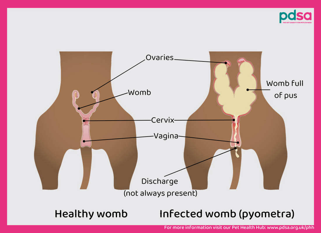 An illustration showing healthy womb next to infected womb