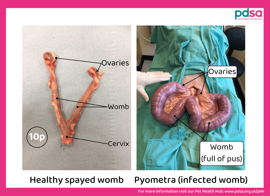 A photo of healthy womb and an infected womb
