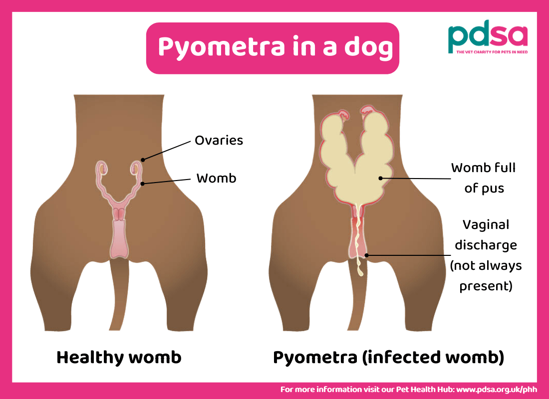 An illustration showing healthy womb next to infected womb