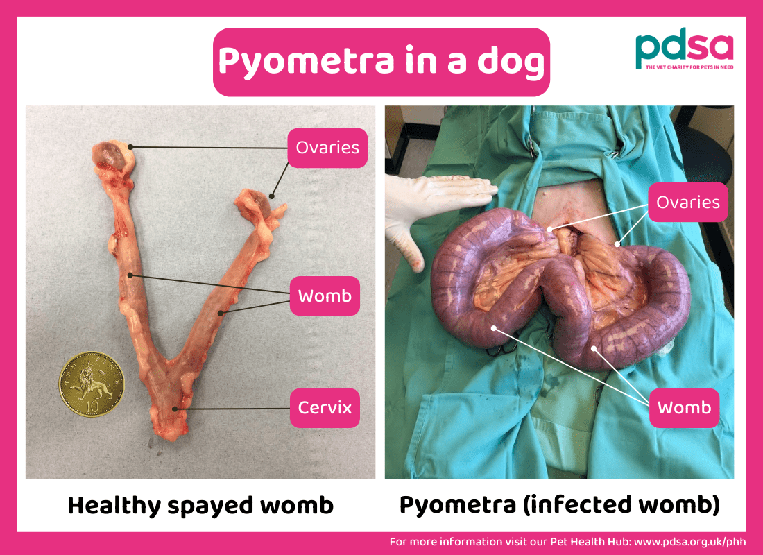 A photo of healthy womb and an infected womb