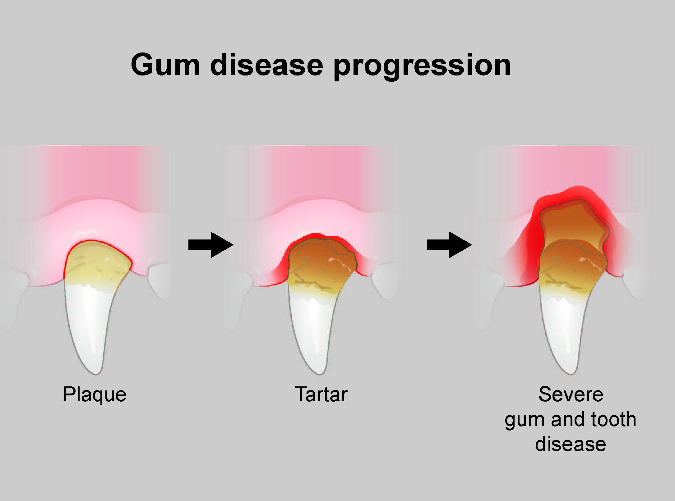 tooth-and-gum-disease-in-dogs-pdsa