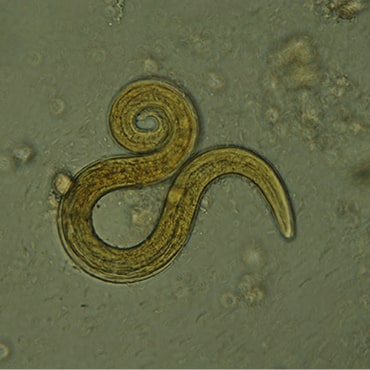 Lungworm viewed under microscope