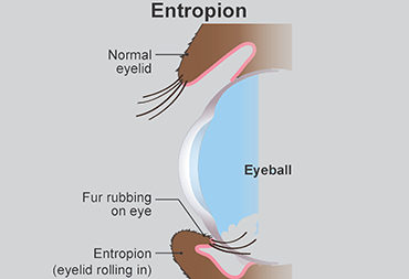 illustration showing entropion