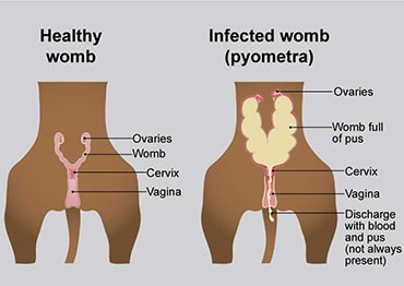 Illustration showing healthy womb next to infected womb