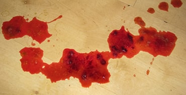 Haemorrhagic gastroenteritis HGE in dogs PDSA