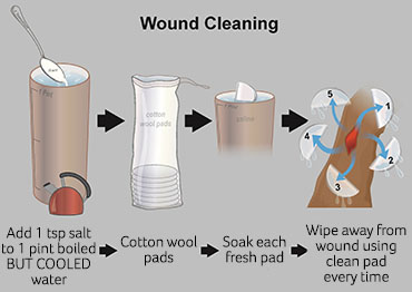 Illustration showing how to make saltwater solution