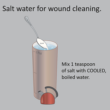 Illustration showing cleaning solution